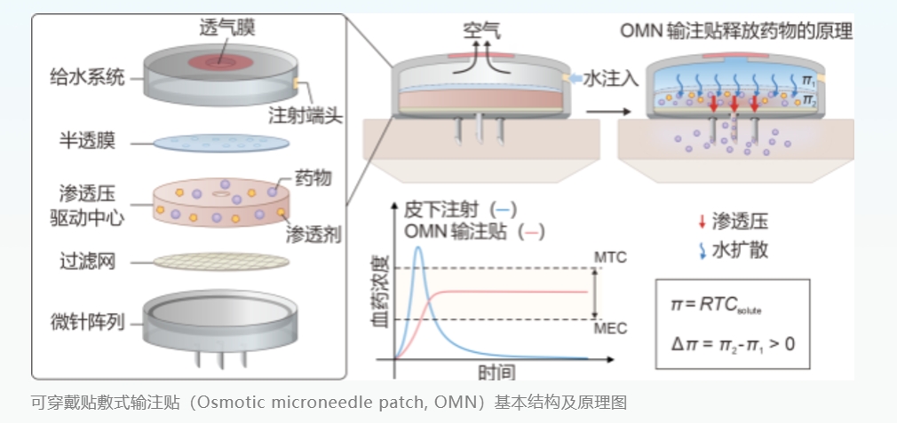 有望实现无痛“无线”挂盐水？浙大团队又一新发明！（附浙大院校解读以及2024录取最低分）